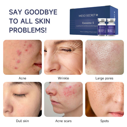 MESO SECRET EXOSOME S For Cell Revival & Skin Regeneration