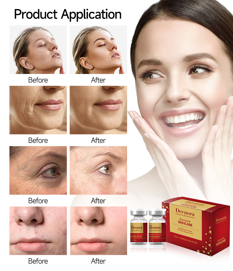 DEENORA Exosome Skinbooster For Skin Regeneration Define Your Natural Beauty